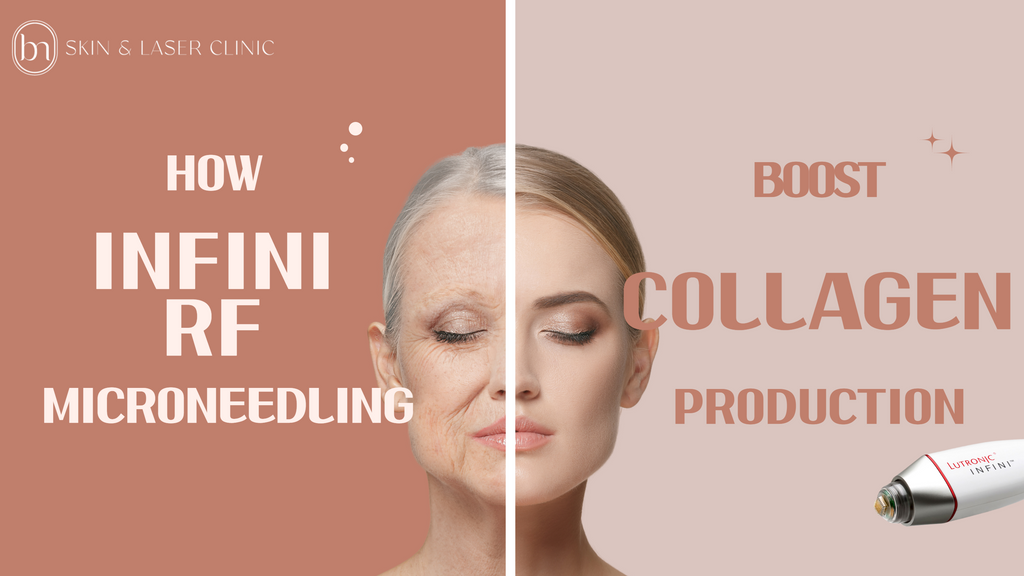 Unlocking the Science of Collagen and Anti-Aging: How Infini RF Microneedling Rejuvenates Your Skin