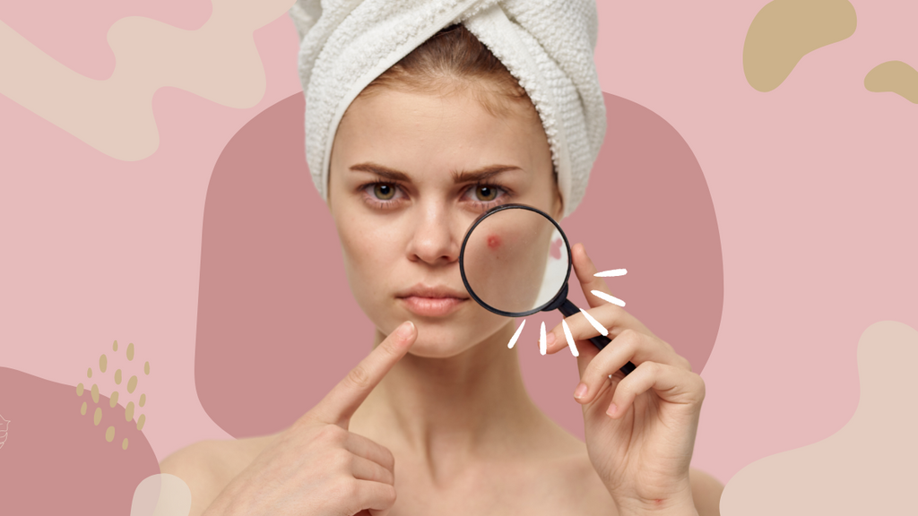 The Best Pore-Reducing Treatments for Smoother, Clearer Skin
