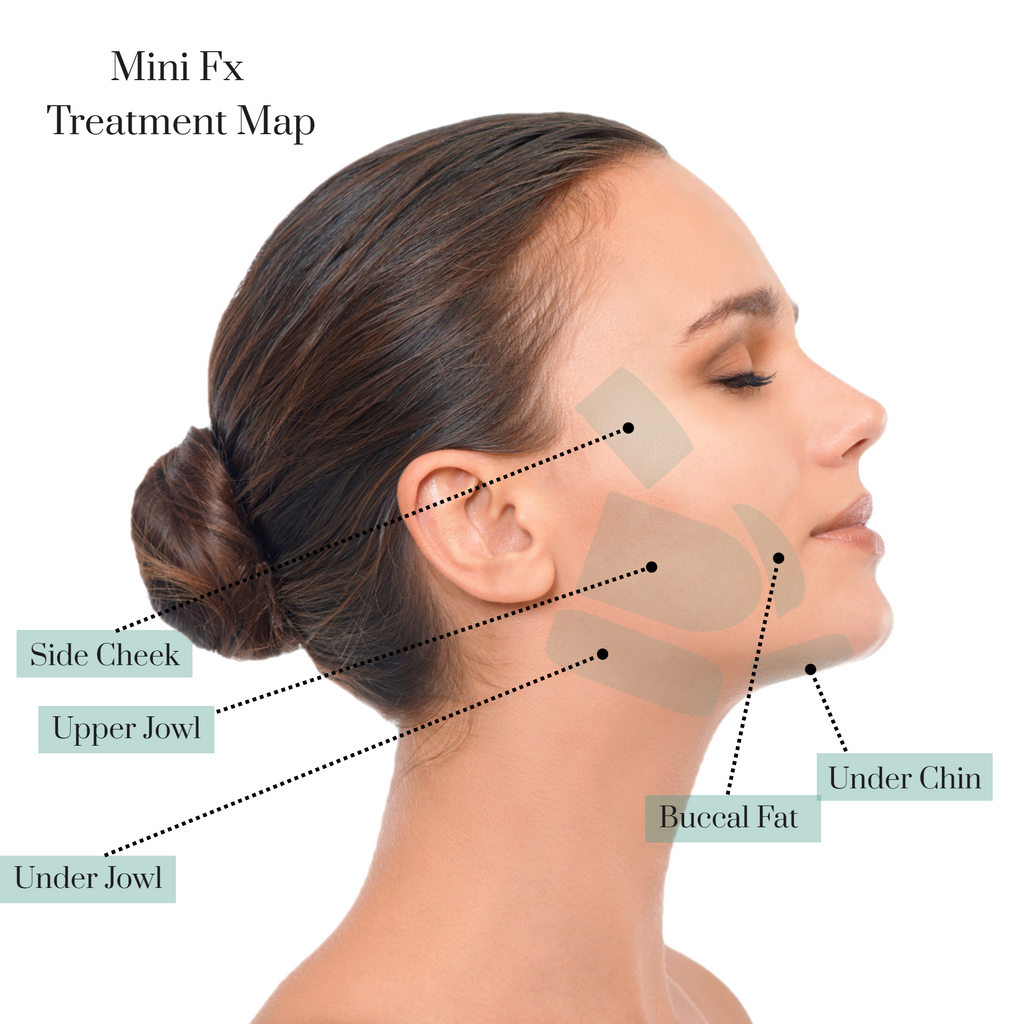 InMode® 2 / 3 step Lifting - West Vancouver | BN Skin & Laser Clinic